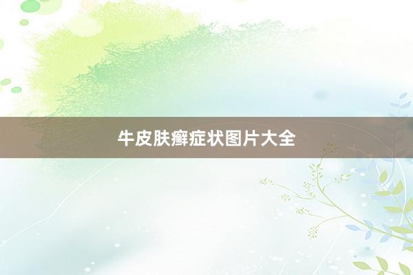 牛皮肤癣症状图片大全